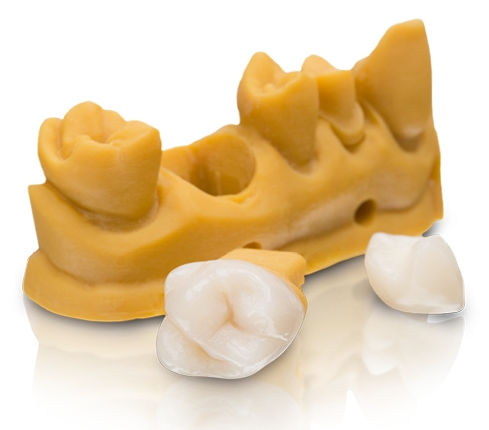 Smile Krone aus dem 3D-Drucker